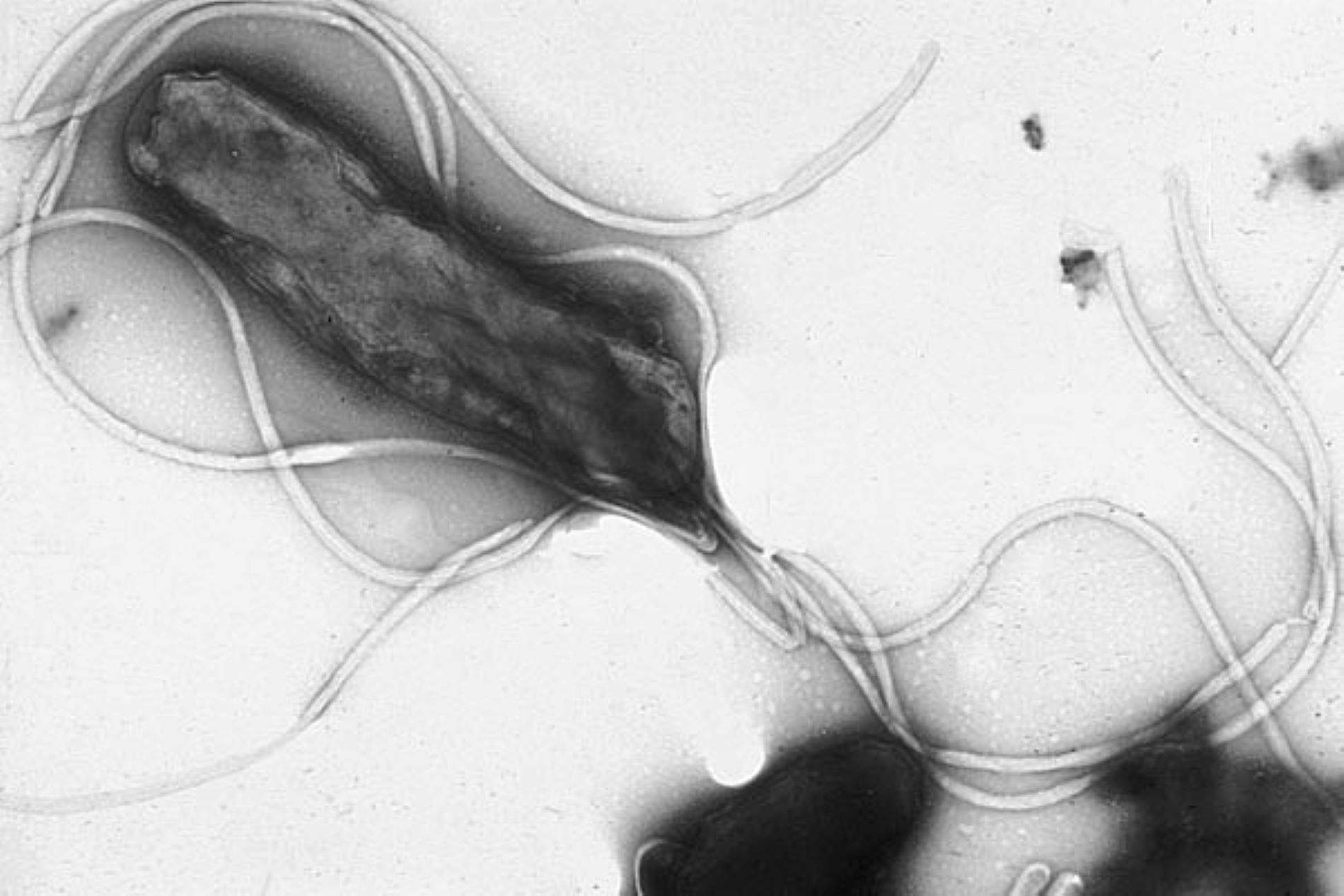 Alerta pel bacteri 'Helicobacter pylori': provocarà prop de dotze milions de càncers d'estómac