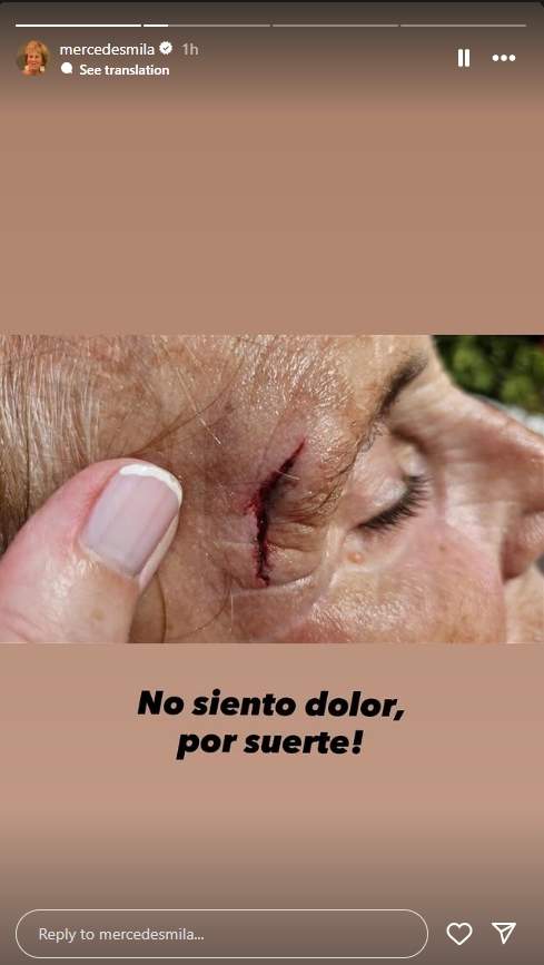 Mercedes Milá herida Instagram (1) Mercedes Milá herida Instagram (1)