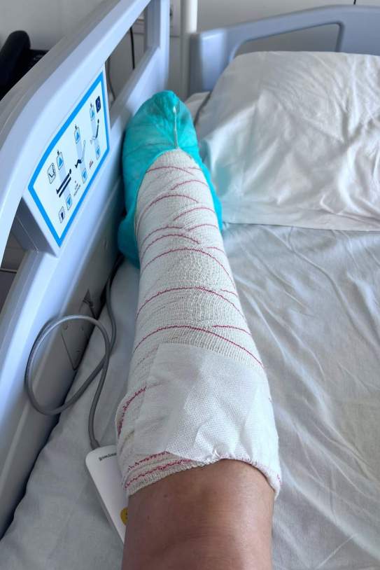 La pierna de Judit Mascó Instagram La pierna de Judit Mascó Instagram