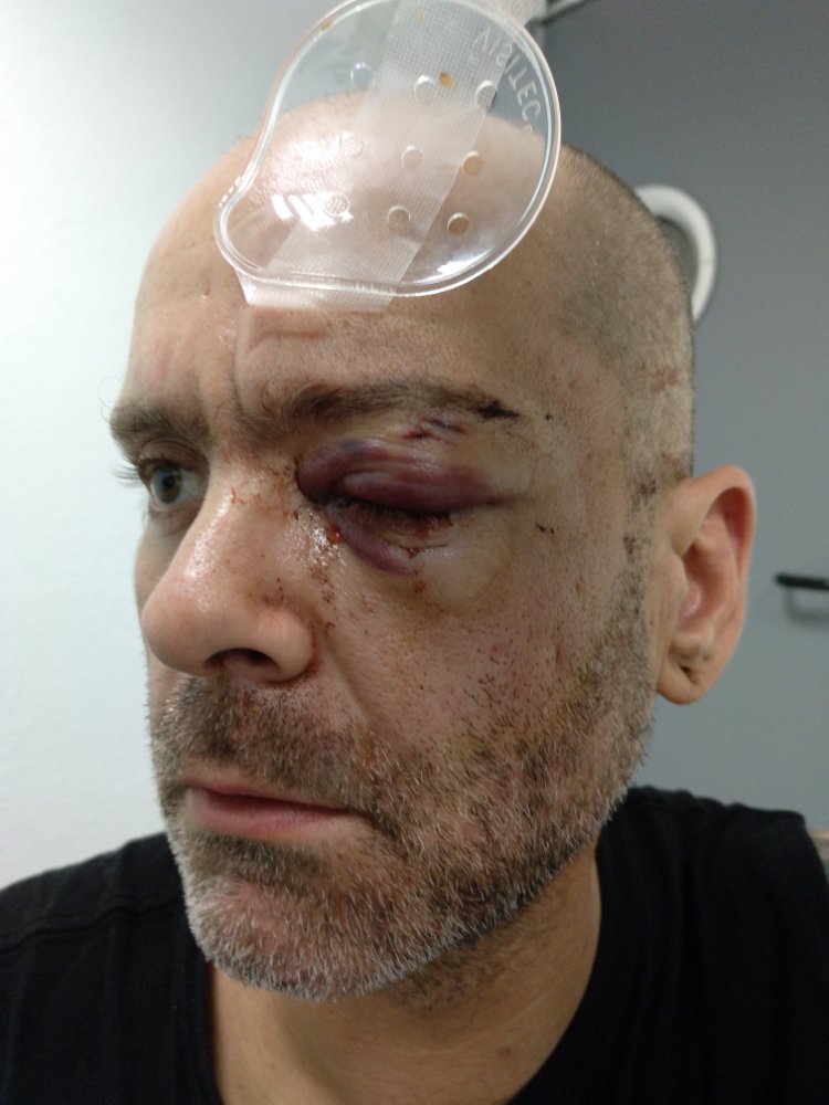 Investigan un mosso que habría perforado el ojo a un hombre en un desalojo