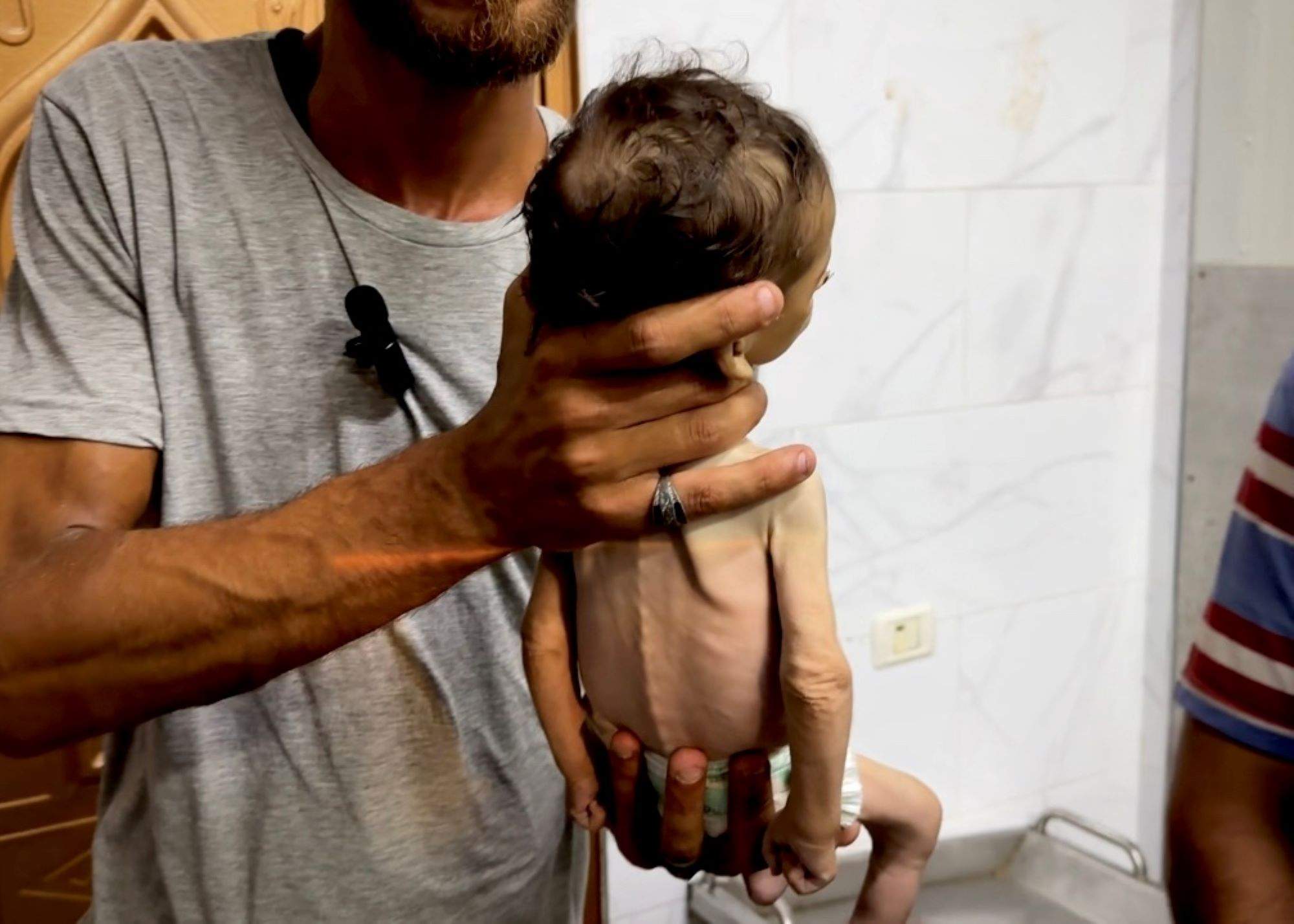 Gaza agonitza de gana: més morts per desnutrició en sis mesos que en dos anys
