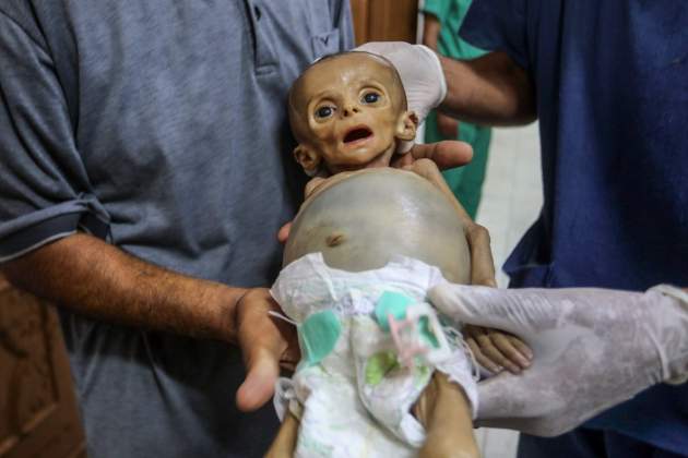 La nadó palestina de sis mesos, Zainab Abu Haleeb, després de la seva mort / Europa Press La nadó palestina de sis mesos, Zainab Abu Haleeb, després de la seva mort / Europa Press