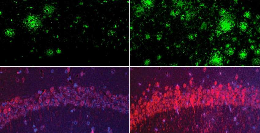Alzheimer en ratolins, nivells liti i beta amiloide / Laboratori Yankner