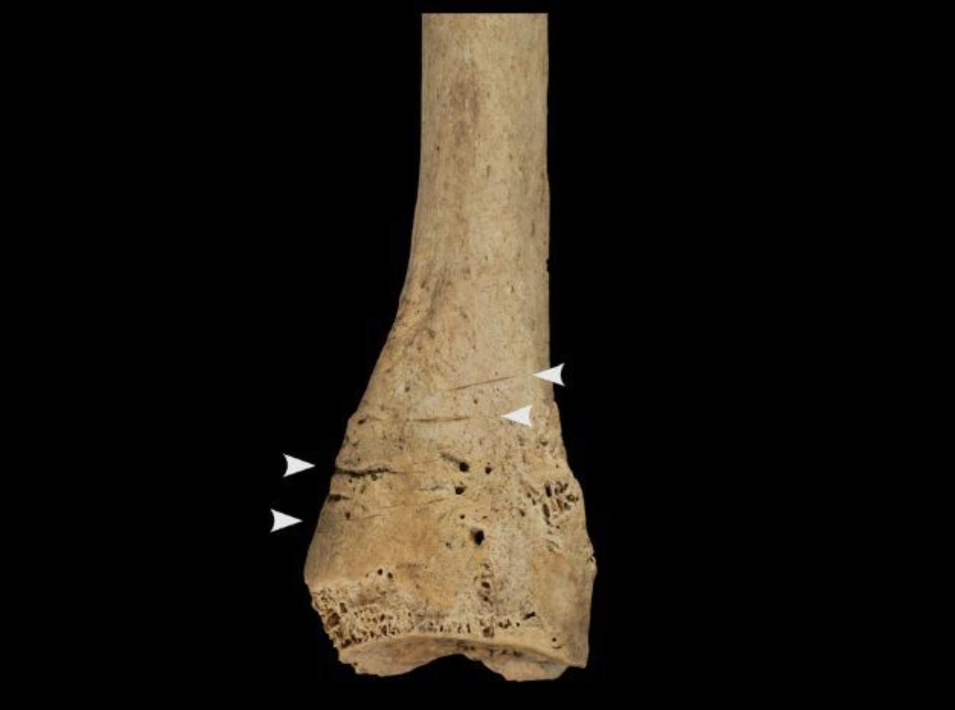 Què ens explica el nou cas de canibalisme de fa 5.700 anys trobat a Atapuerca