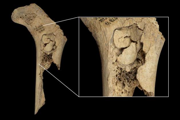 Femur canibalisme Atapuerca