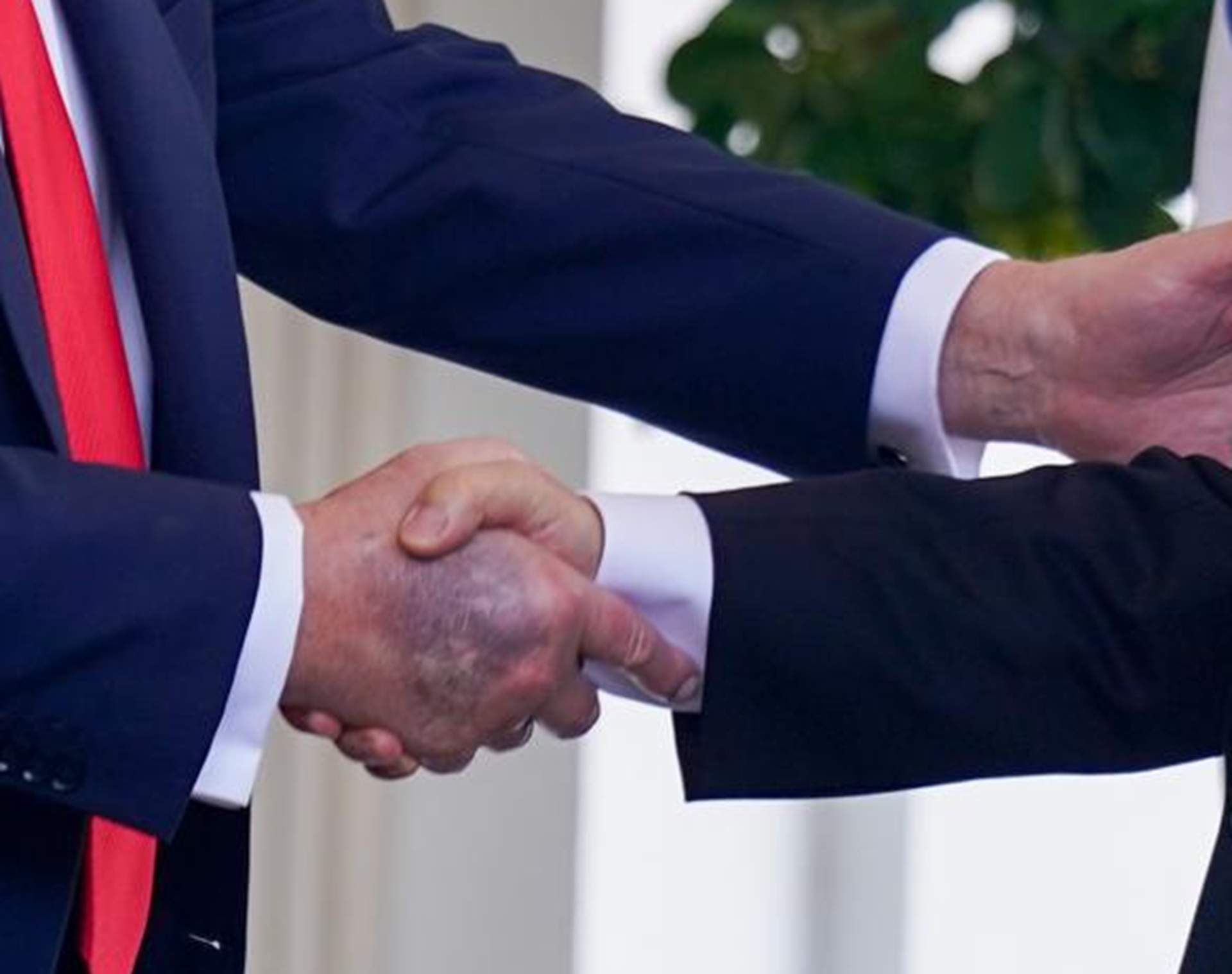 Qué se sabe sobre la mancha de la mano de Donald Trump, que oculta con maquillaje