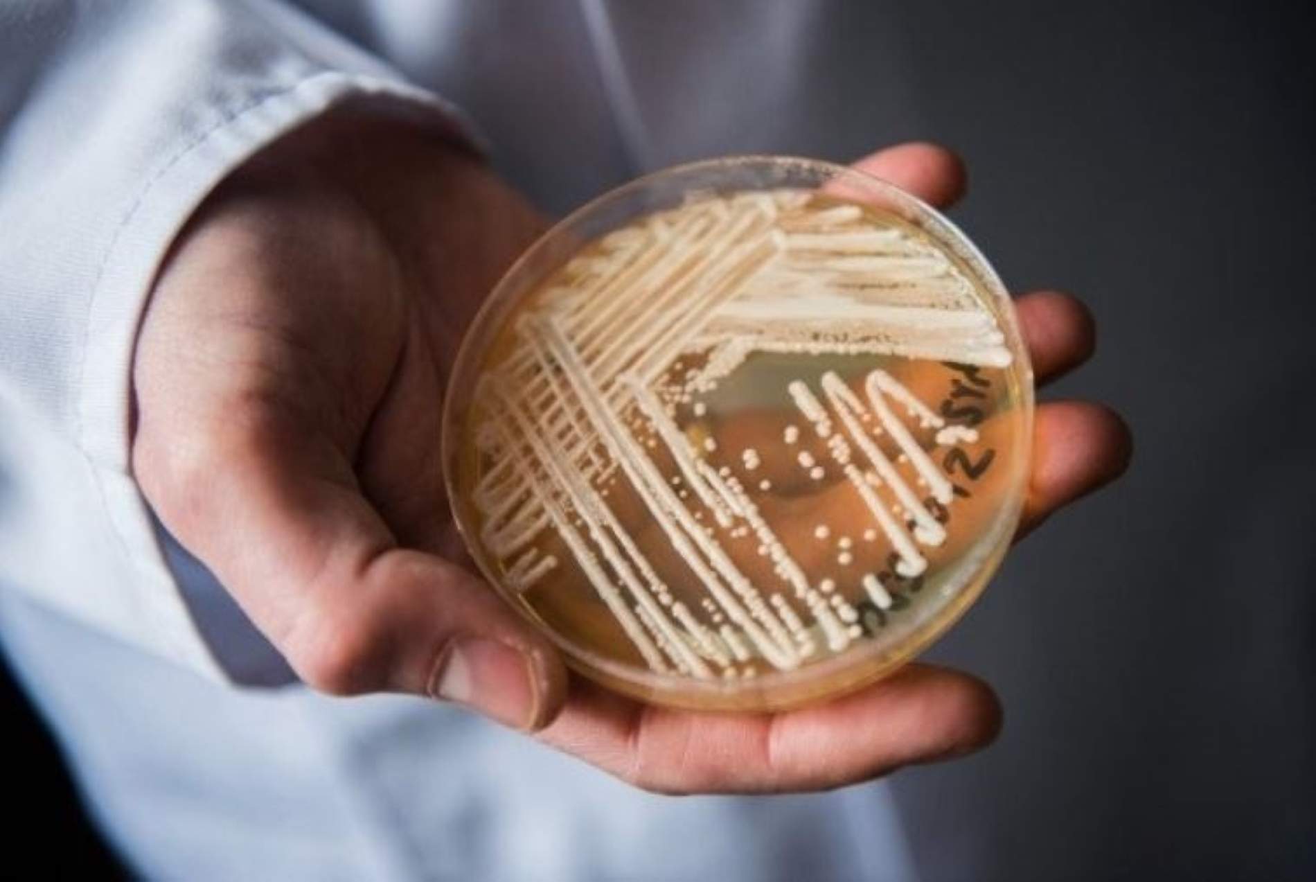 Què és 'Candida auris', el fong que preocupa Europa per la seva alta transmissió a l'Estat