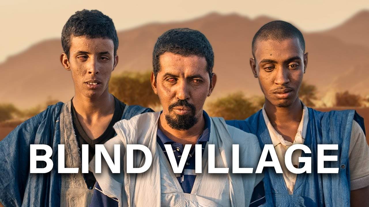 Dali Koumbè, el pueblo de los hombres sin ojos del Sahara: “La medicina no encuentra una explicación”