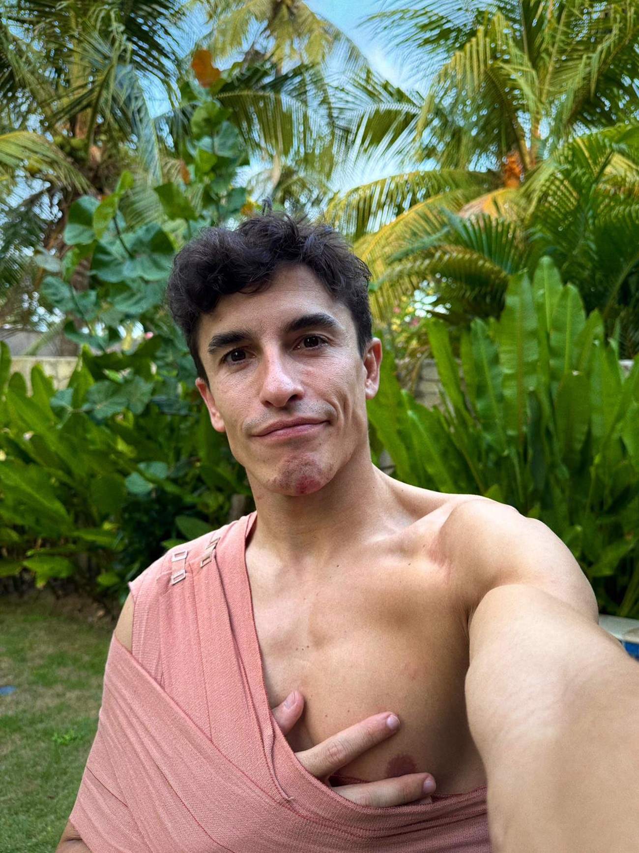 Ya se conoce el alcance de la lesión de Marc Márquez: pronóstico agridulce para el campeón del mundo