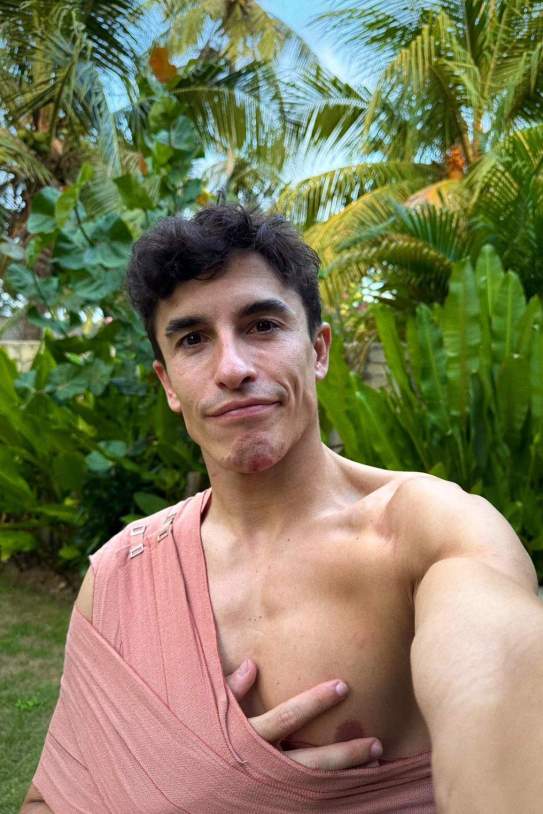 Marc Márquez Lesión / Foto: @marcmarquez93