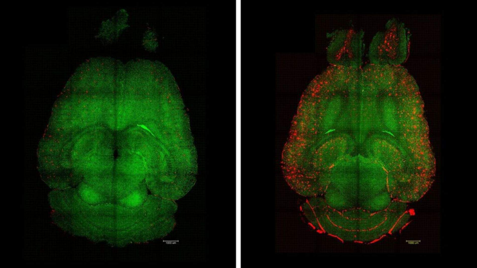 Revierten el Alzheimer en ratones con tres inyecciones de nanopartículas