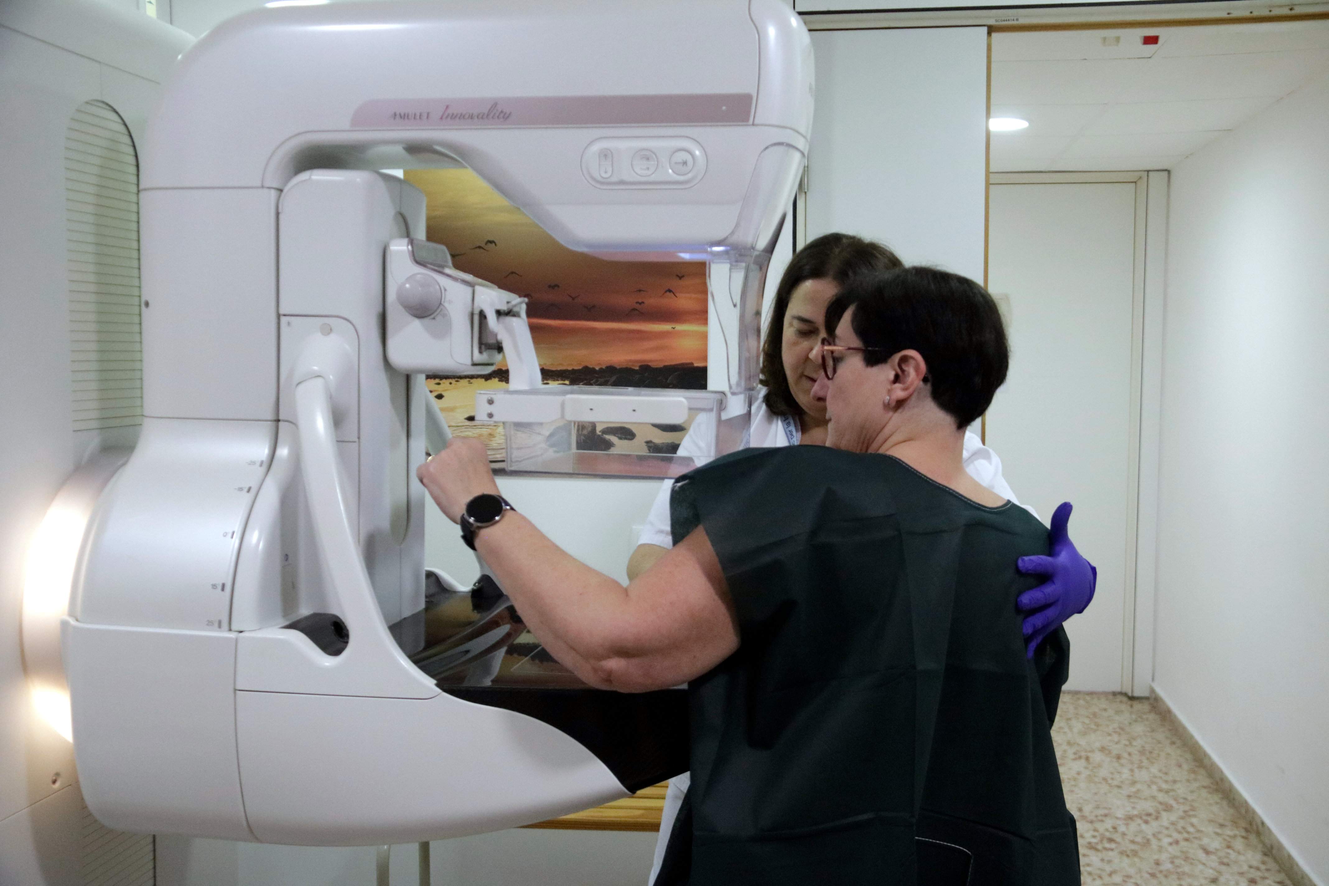 La crisi de les mamografies a Andalusia fa créixer el neguit a Catalunya i es multipliquen les trucades