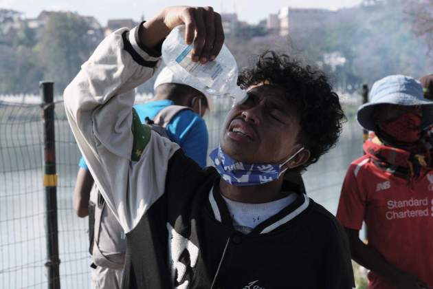 Un manifestante intenta paliar los efectos del gas en sus ojos / EFE Un manifestante intenta paliar los efectos del gas en sus ojos / EFE