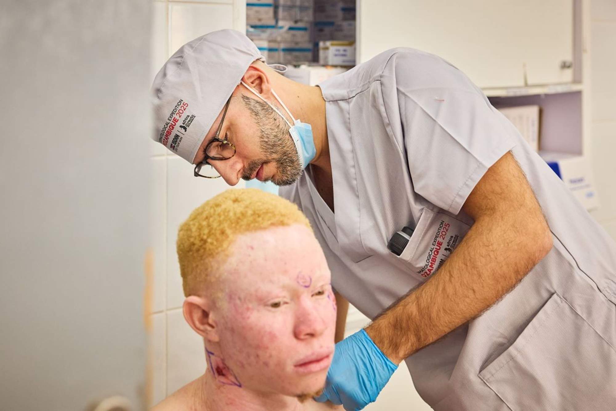 ISDIN i Àfrica Directe atenen més de 250 persones amb albinisme a Moçambic contra el càncer de pell