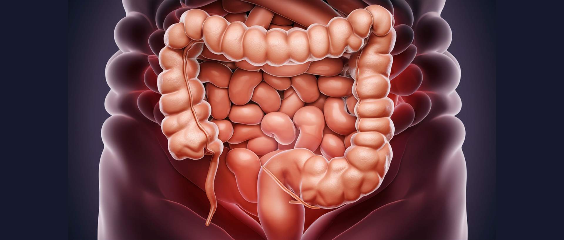 Un estudi català descobreix com el càncer colorectal metastàtic bloqueja la immunoteràpia amb un doble escut