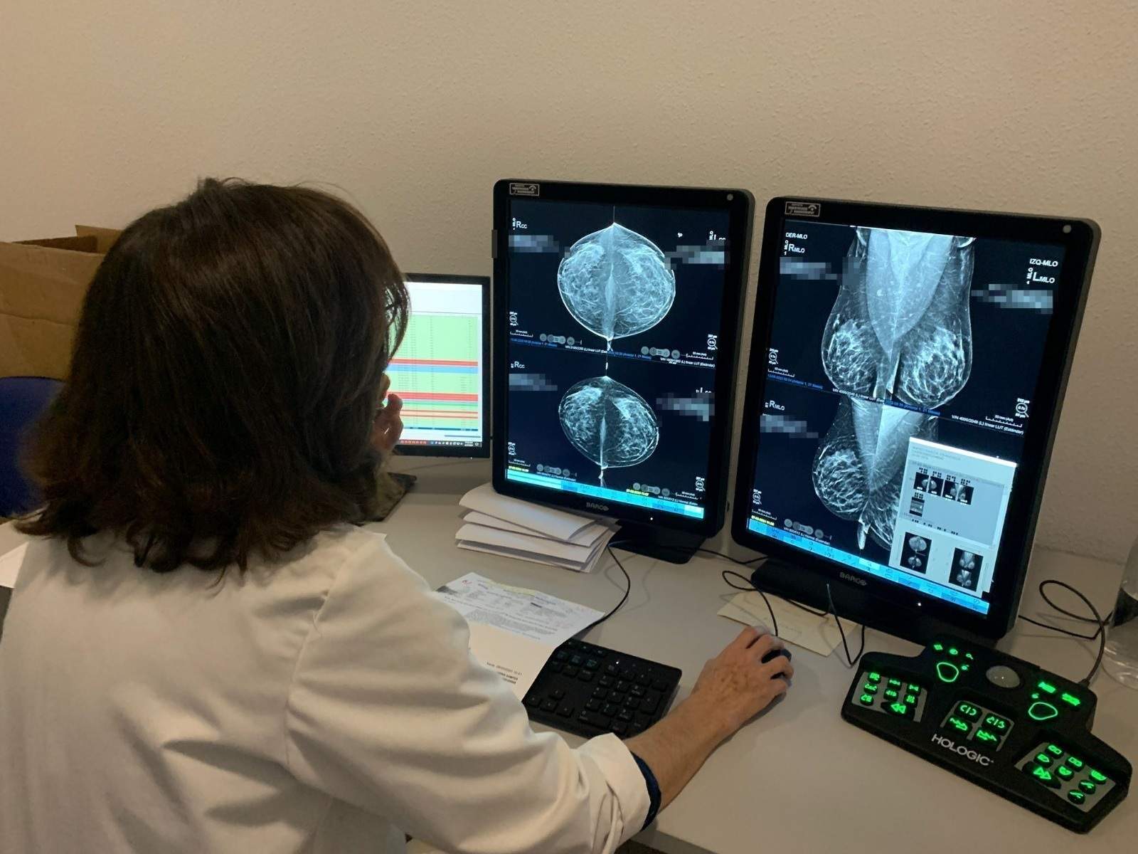 La Fiscalía archiva la denuncia de las víctimas del cribado de cáncer de Andalucía