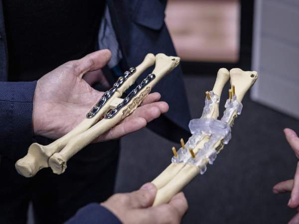 FOCUS ON Innovació #11 Ferran Fillat-Gomà protesis / Foto: Carlos Baglietto FOCUS ON Innovació #11 Ferran Fillat-Gomà protesis / Foto: Carlos Baglietto