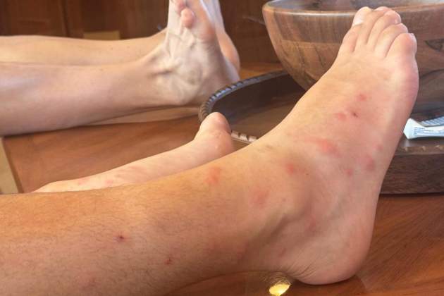 carlitosalcarazz 1765395325 3784732760888722147 3227641356 carlitosalcarazz 1765395325 3784732760888722147 3227641356