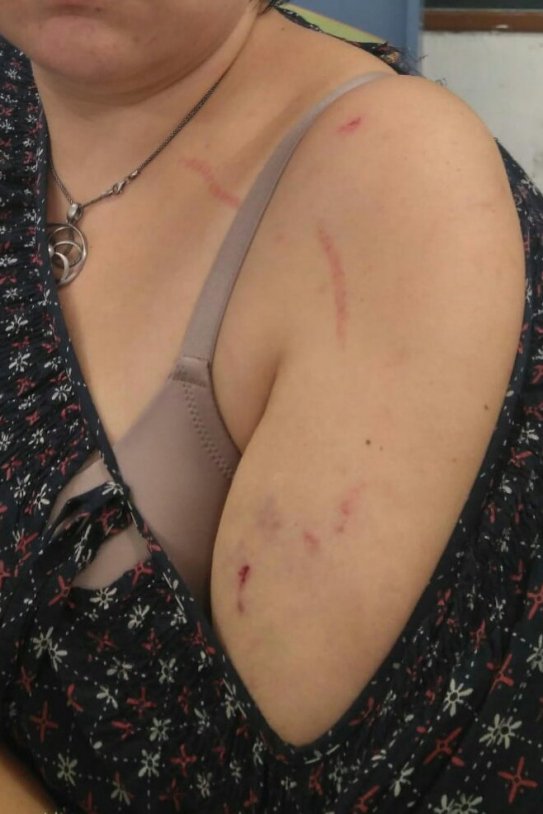 Lesions dona llaços grocs Torrefarrera ACN