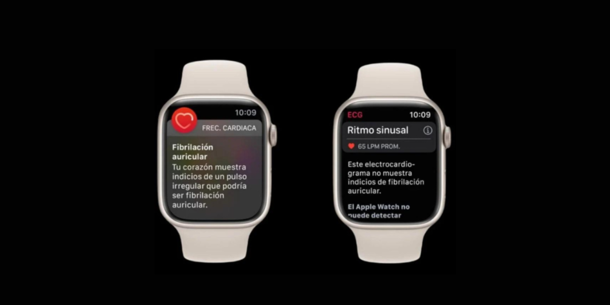 El Apple Watch detecta un problema cardaco oculto que ha podido salvar ...