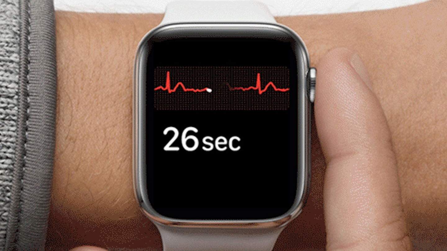 Com fer un electrocardiograma a l'Apple Watch