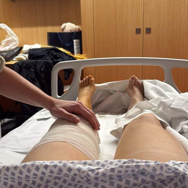 Imagen de horas después de la operación de Cata Coll / Instagram Imagen de horas después de la operación de Cata Coll / Instagram