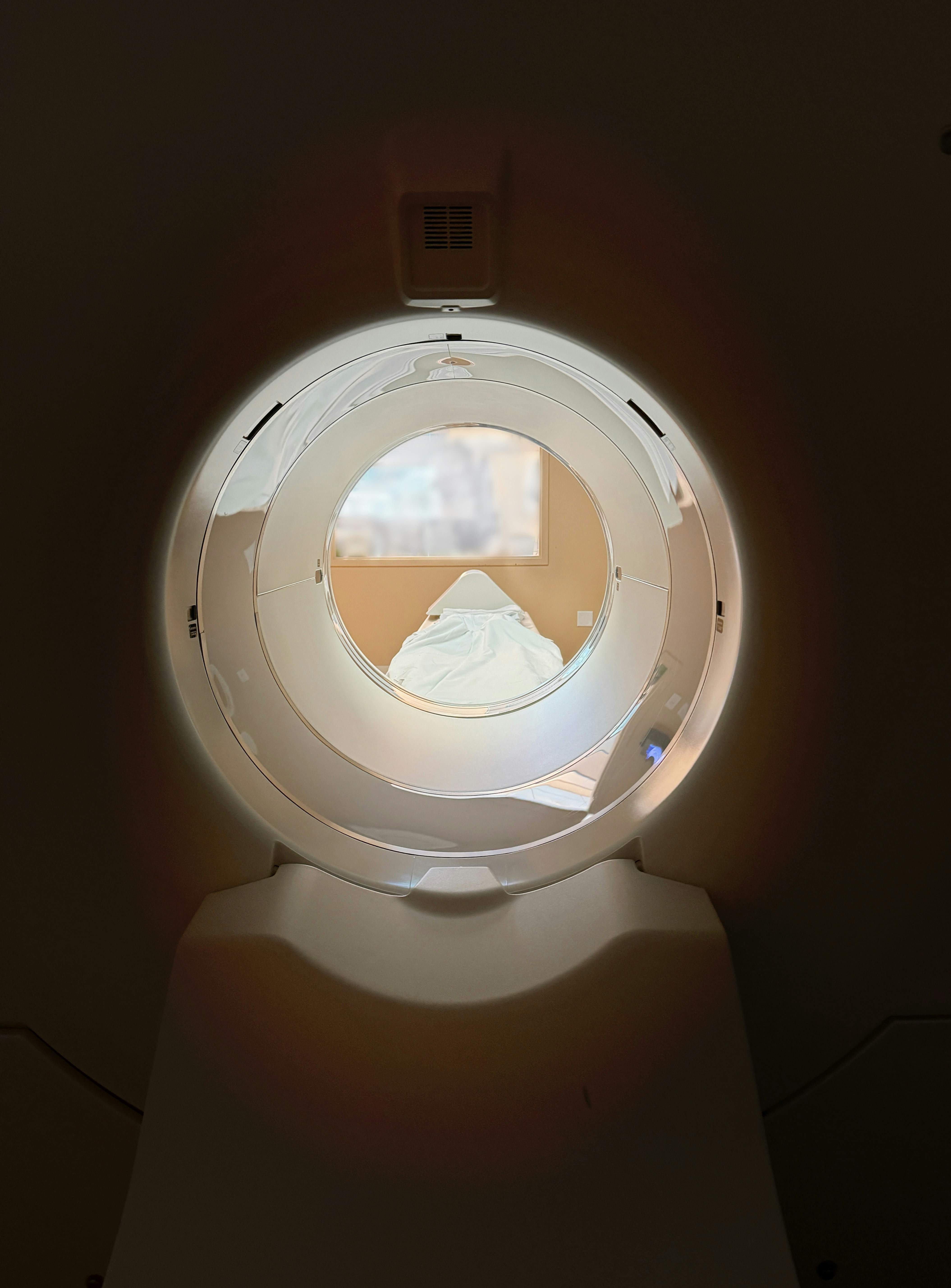 ASTUCE Spain urge al Ministerio de Sanidad a reconocer el oligodendroglioma como enfermedad rara