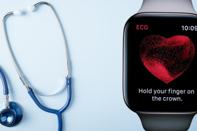L'Apple Watch va trobar arítmies que no van poder detectar els monitors cardíacs tradicionals L'Apple Watch va trobar arítmies que no van poder detectar els monitors cardíacs tradicionals
