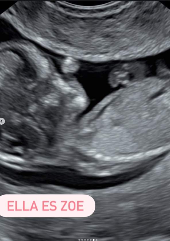 Zoe, la hija de Laura Moure IG