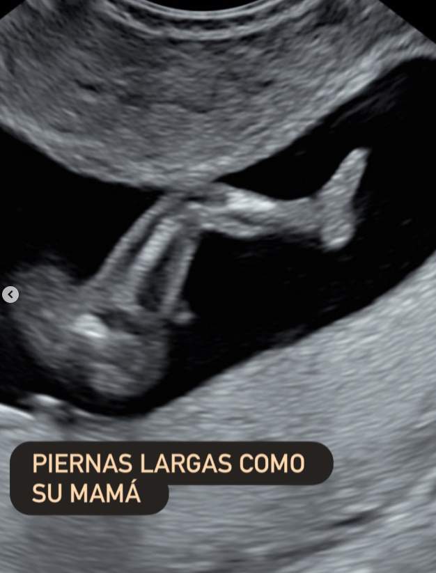 Zoe, la hija de Laura Moure IG2