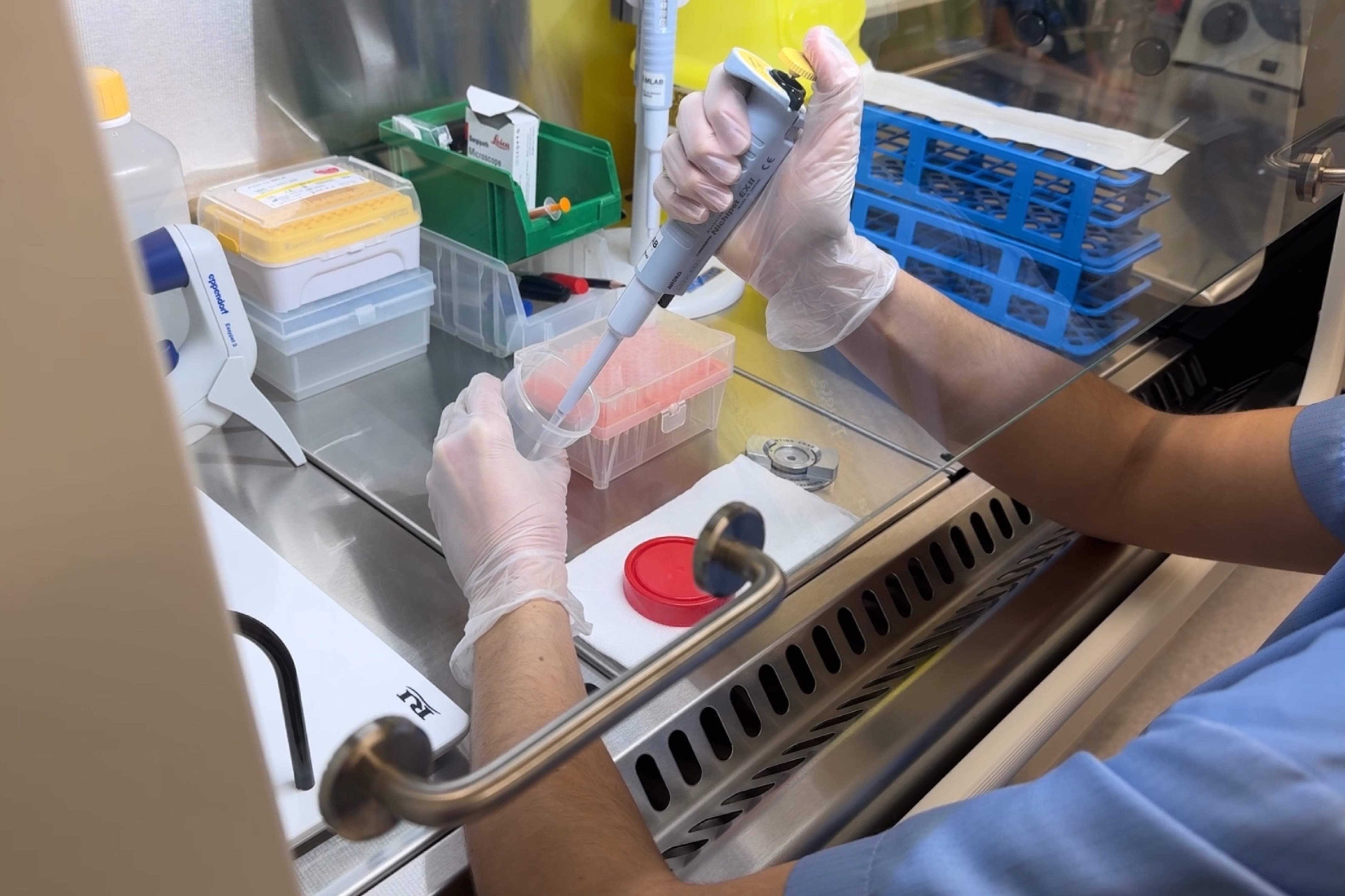 Detecten tres casos d’una malaltia minoritària transmesa per un mateix donant de semen a Catalunya