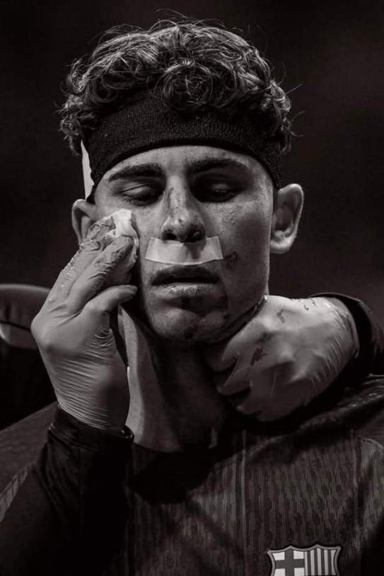 La herida de Fermín López / Instagram