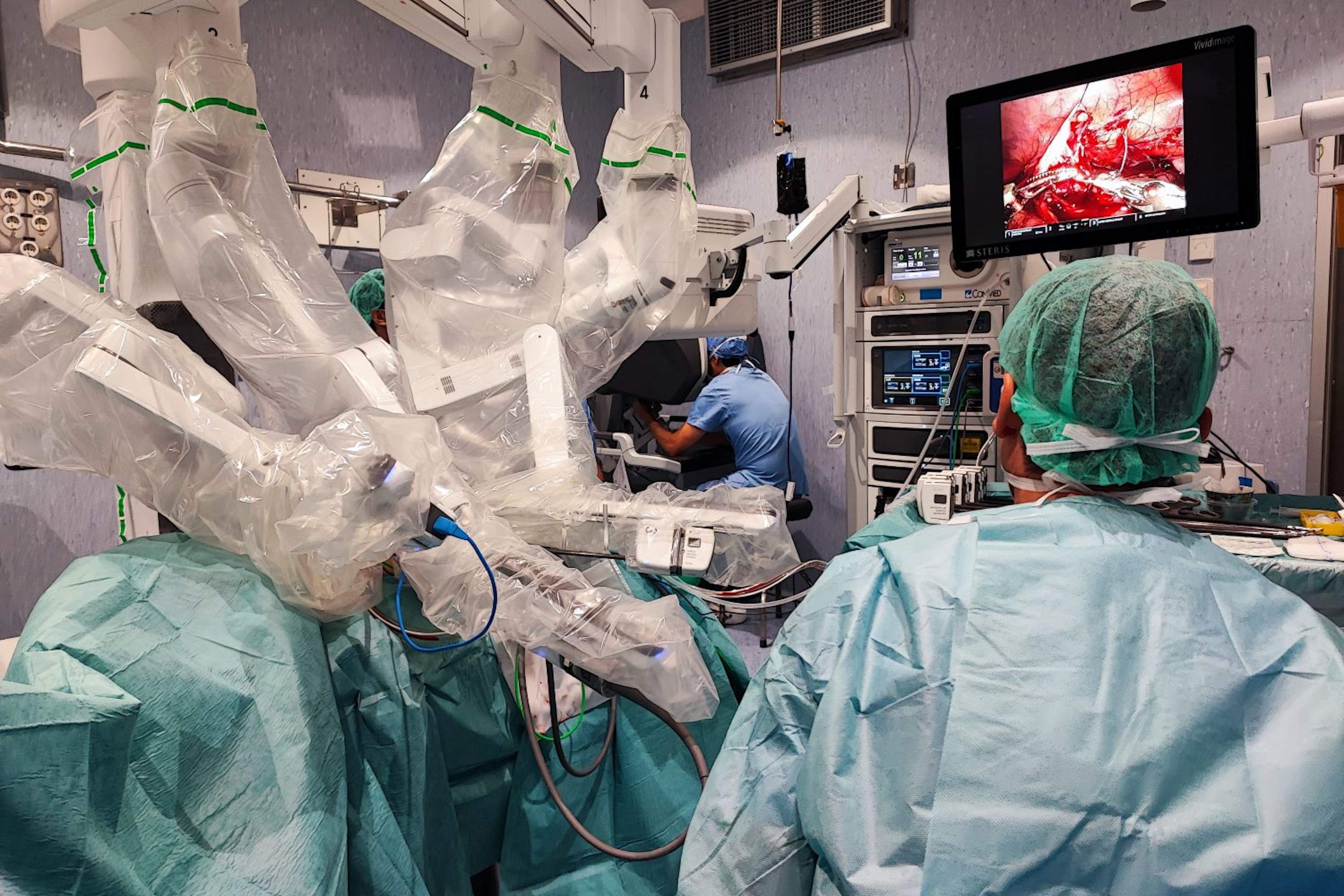 Cirurgia robòtica a l'hospital Trueta de Girona / ACN