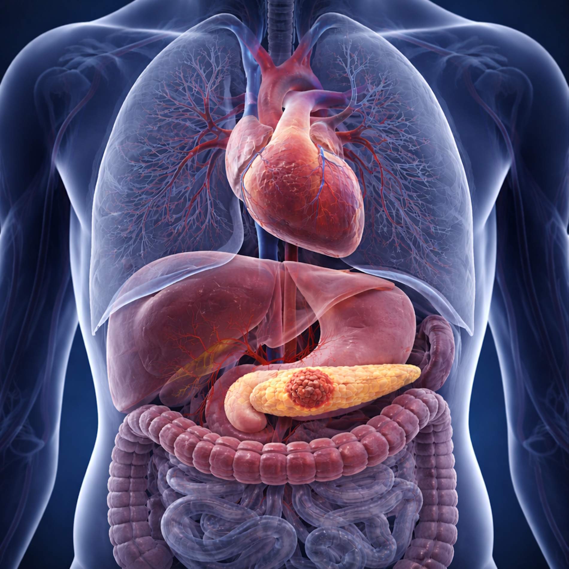 Un avance alentador en la lucha contra el cáncer de páncreas: el fármaco que marcará “un antes y un después"