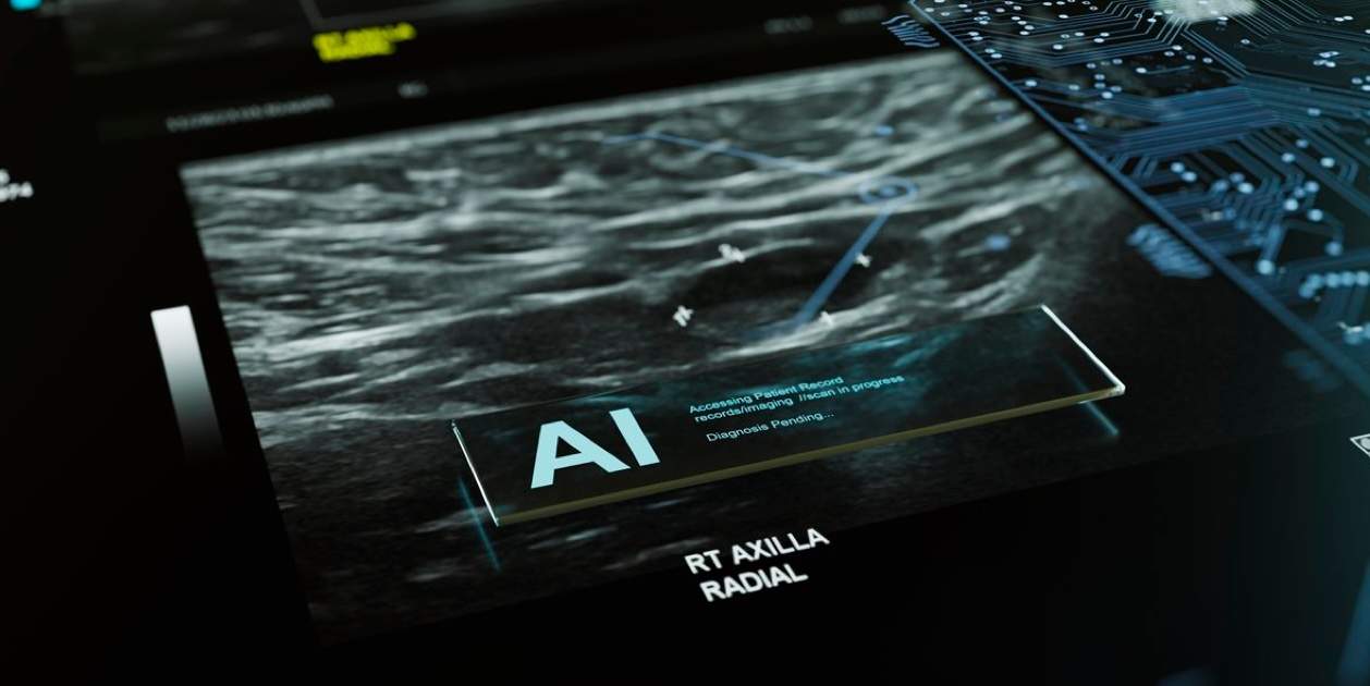 La inteligencia artificial puede detectar el cáncer de páncreas con años de antelación