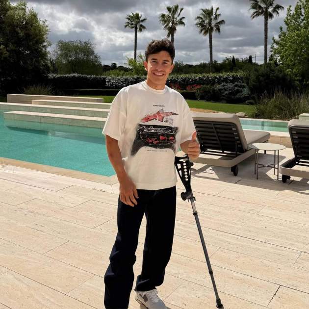 Marc Márquez després de l'operació / Instagram