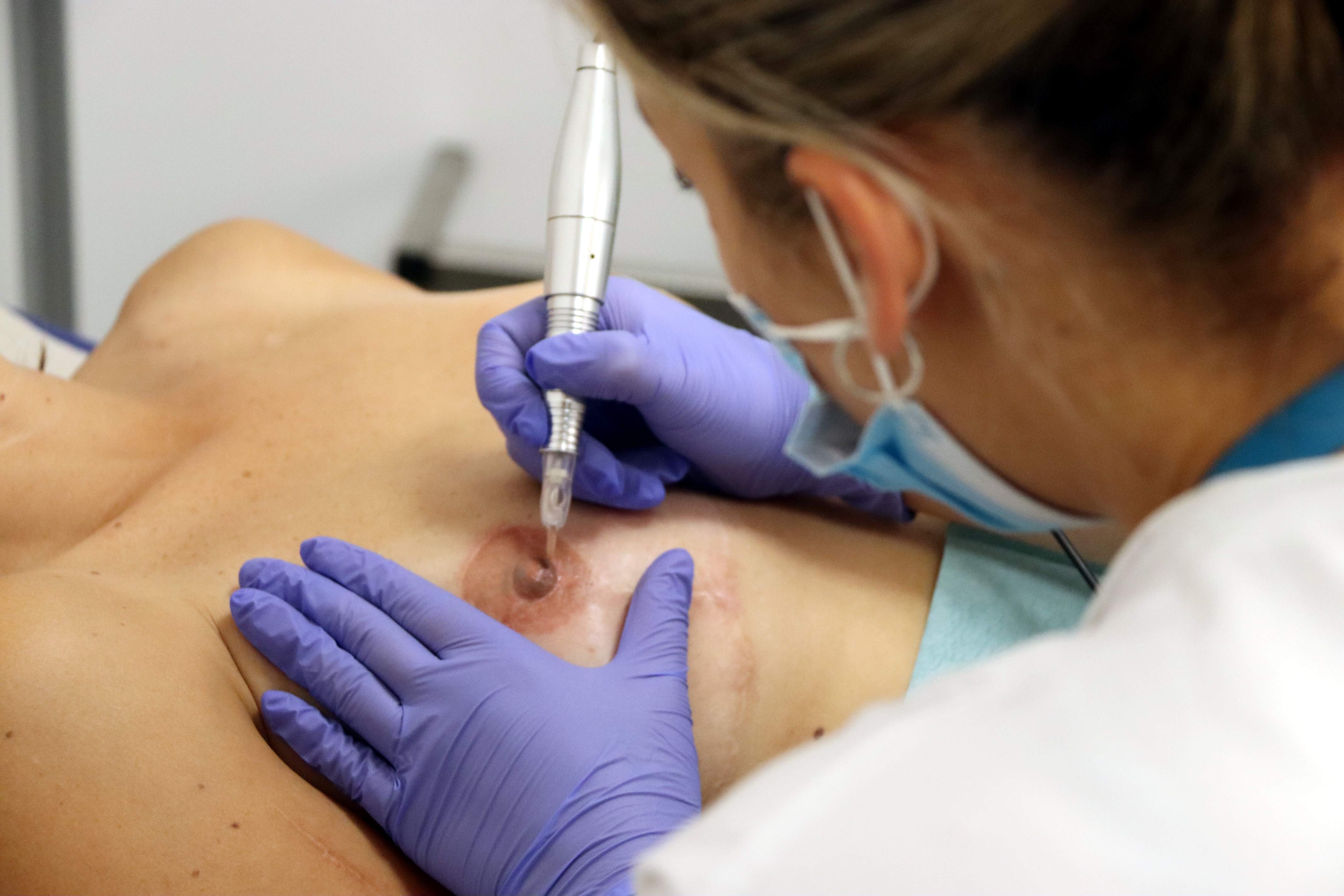 Sanitat aprova ampliar el cribratge de càncer de mama a dones d’entre 45 i 74 anys