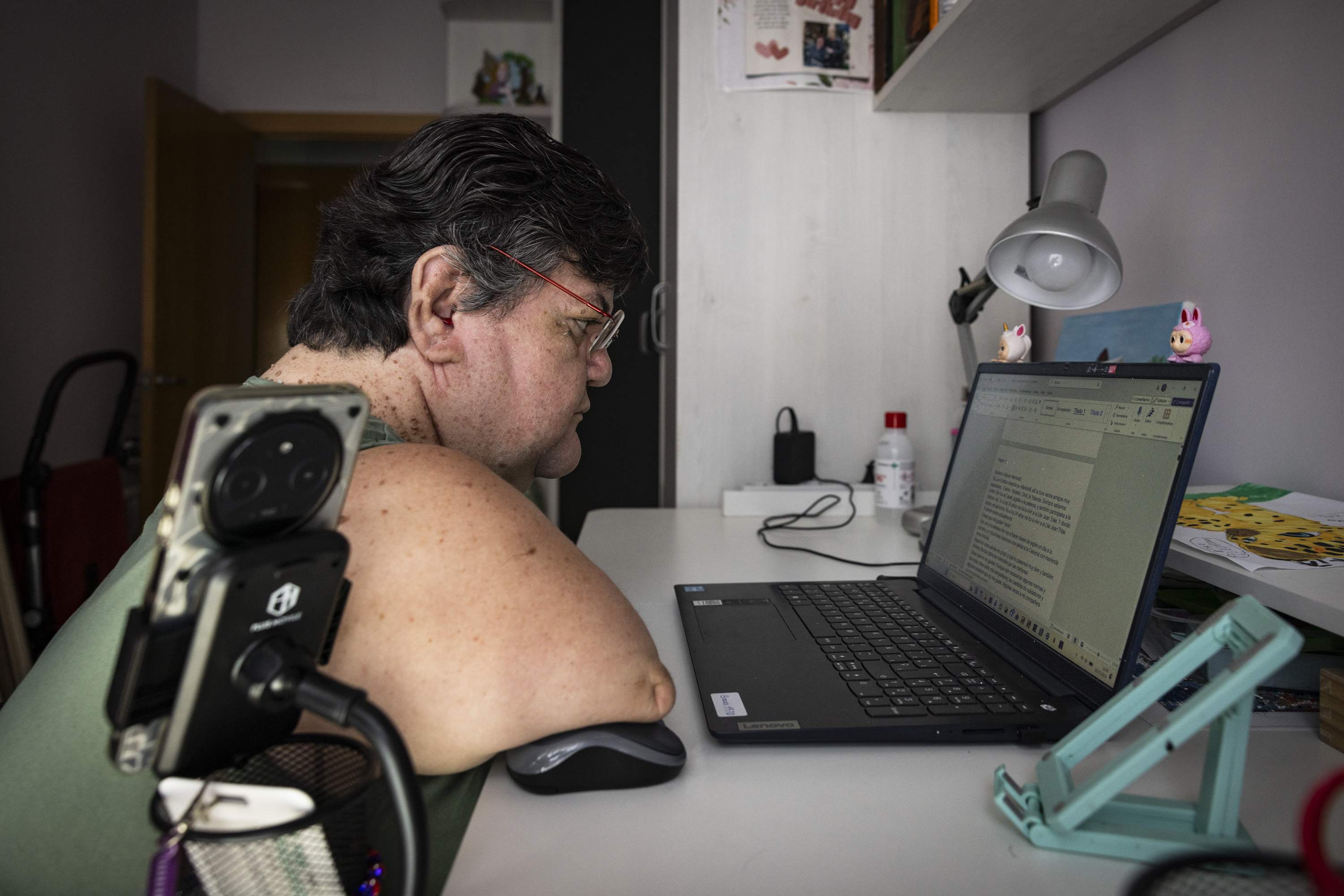 Reportatge persones amb discapacitat, Talidomida i els efectes secundaris / Foto: Carlos Baglietto