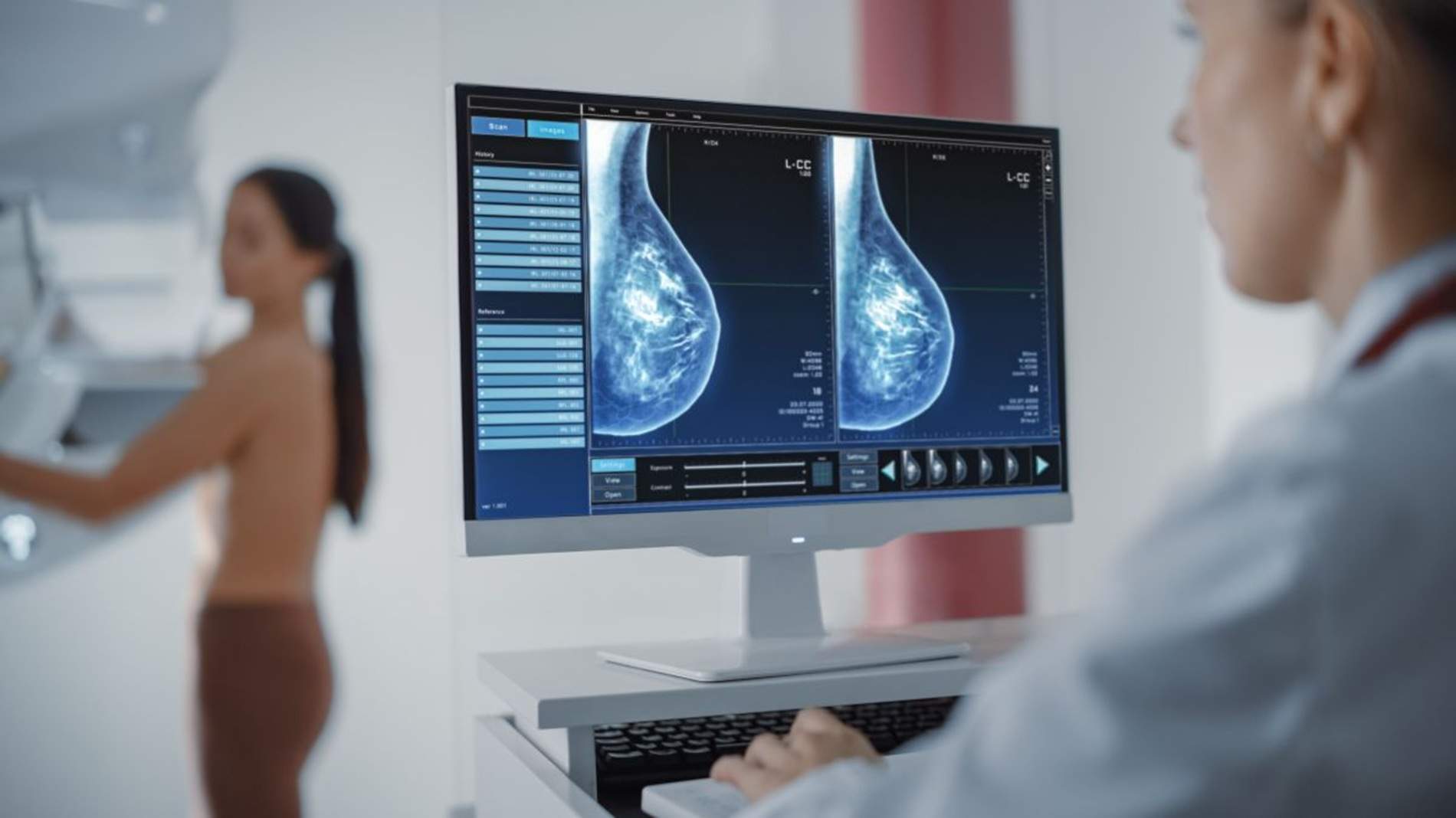 La SECA, la Fundació ECO i Novartis presenten un nou model assistencial integrat en càncer de mama precoç