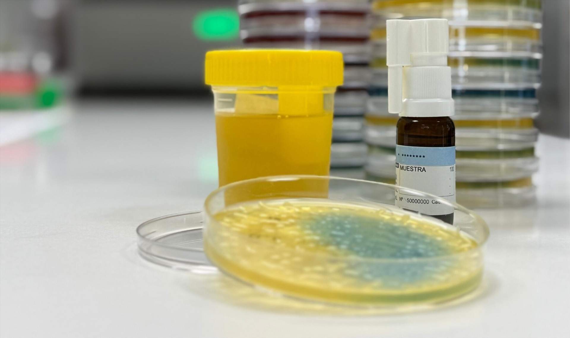 La vacuna catalana que pot posar fi a les infeccions d'orina recurrents