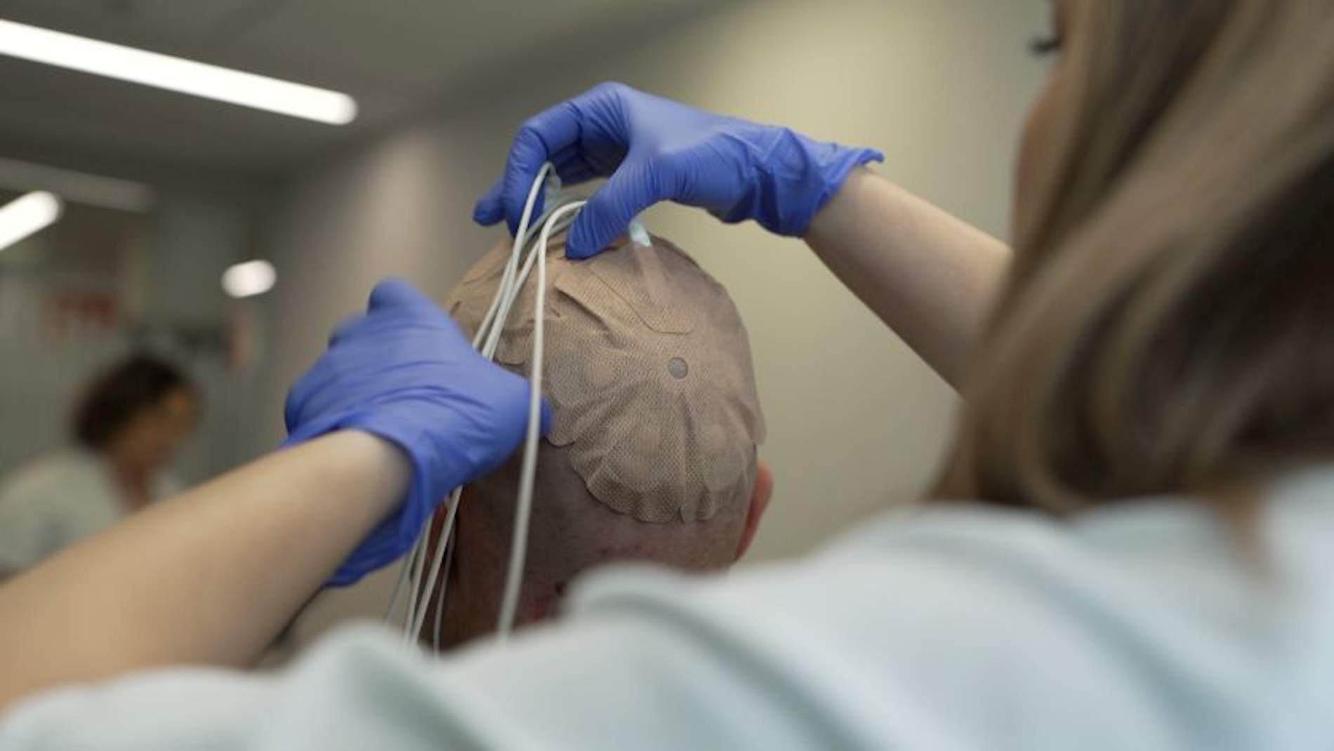 L'Hospital 12 d'Octubre prova un nou tractament contra el glioblastoma