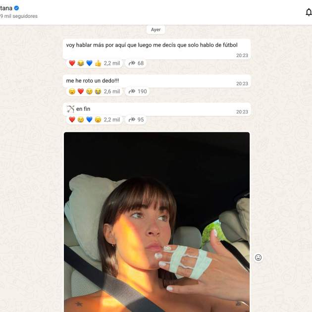 Aitana explica que s'ha trencat el dit / Instagram Aitana explica que s'ha trencat el dit / Instagram