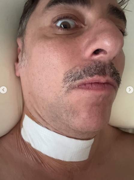 La cicatriu de l'operació, Ig La cicatriu de l'operació, Ig