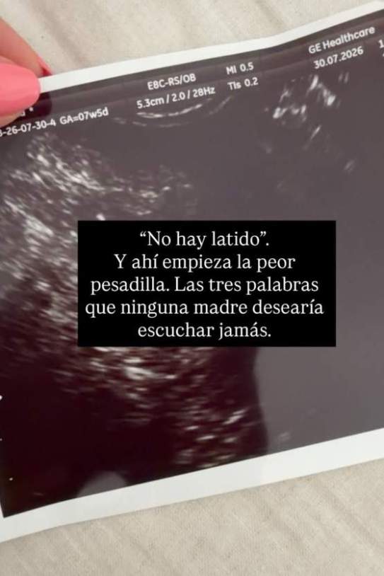 Delicious Martha ha perdut el fill que esperava IG Delicious Martha ha perdut el fill que esperava IG