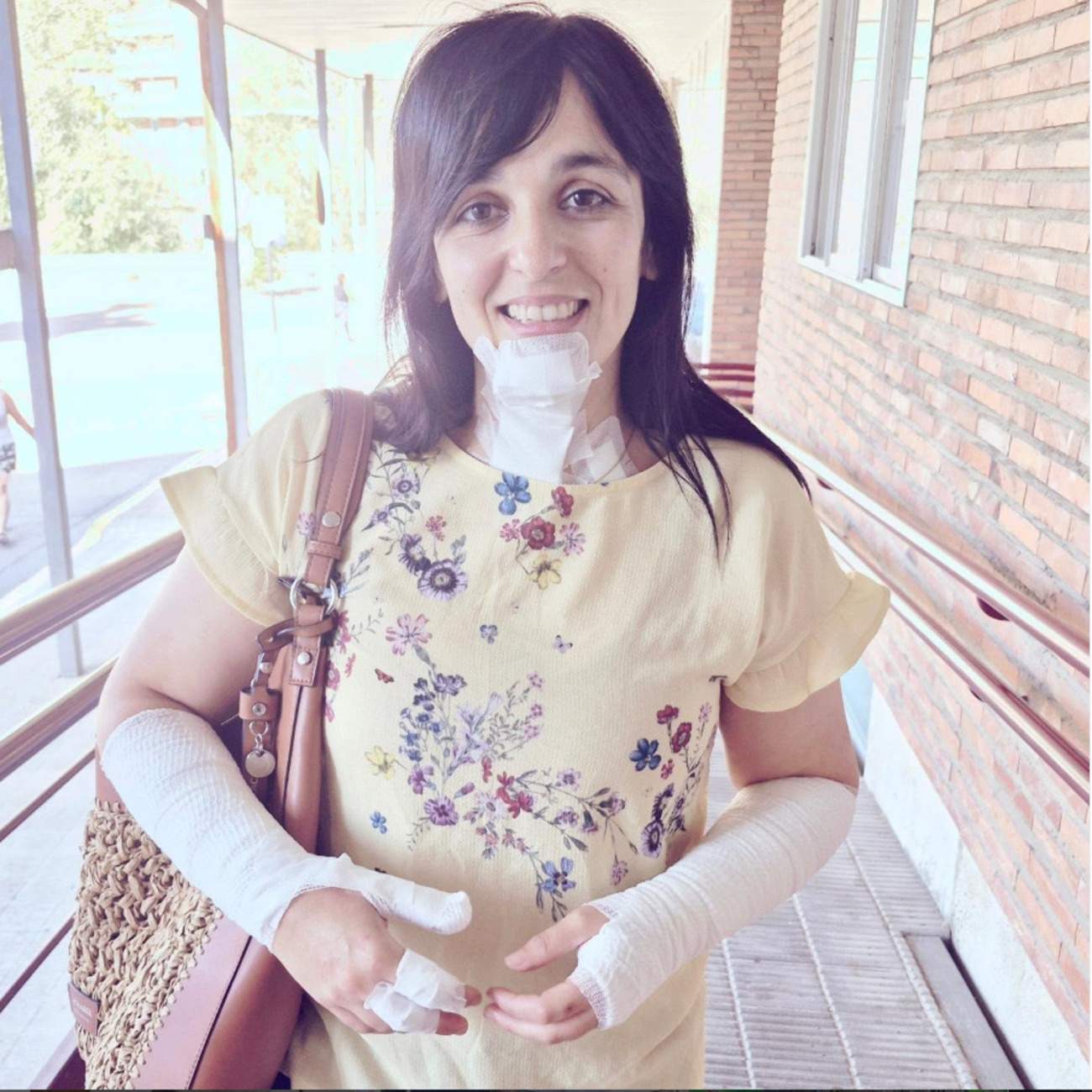 Accident domèstic de Sílvia Orriols: "No és que vagi disfressada de mòmia..."