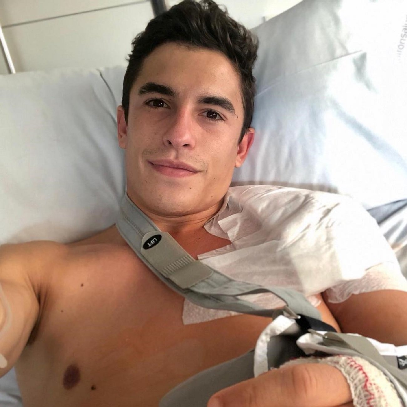 Marc Márquez passa pel quiròfan