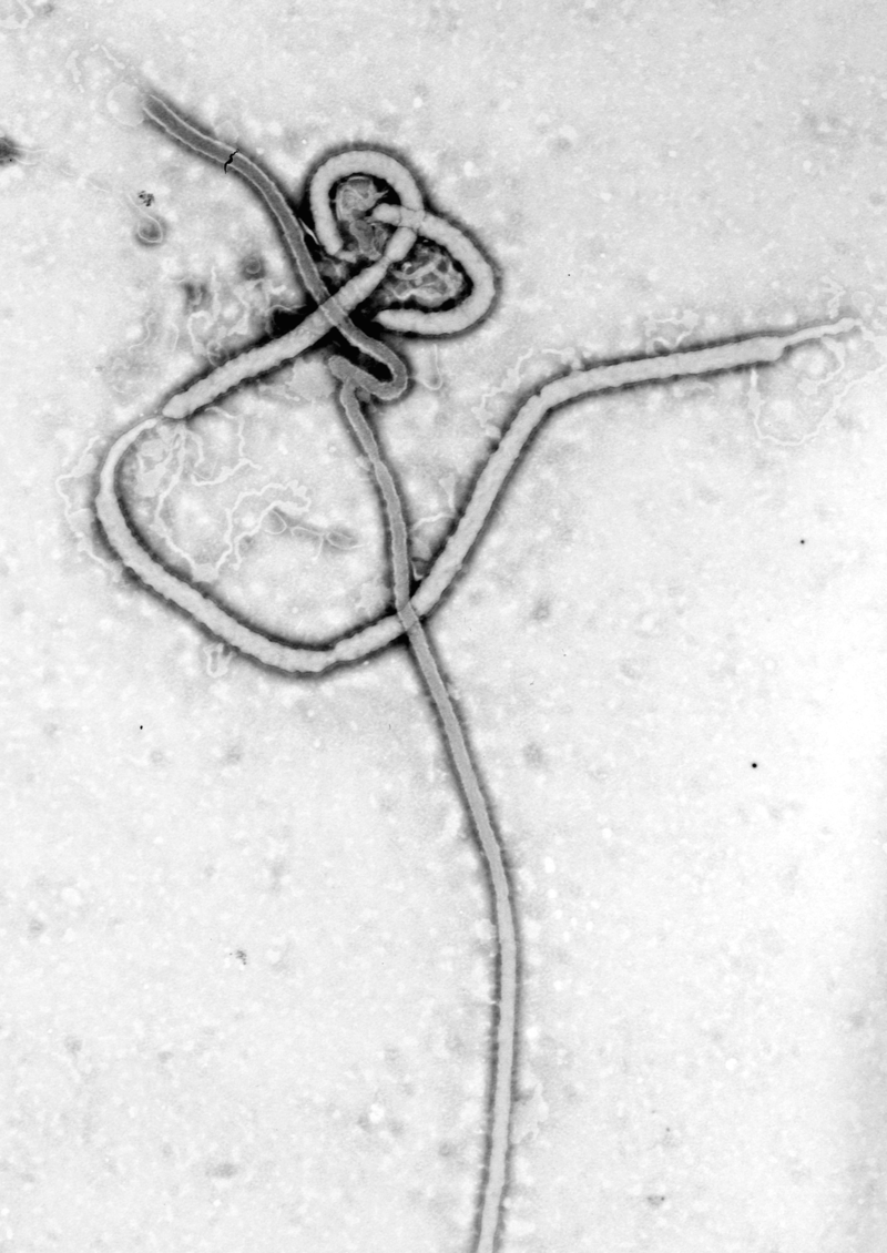 El ébola mata a 283 personas en la República Democrática del Congo