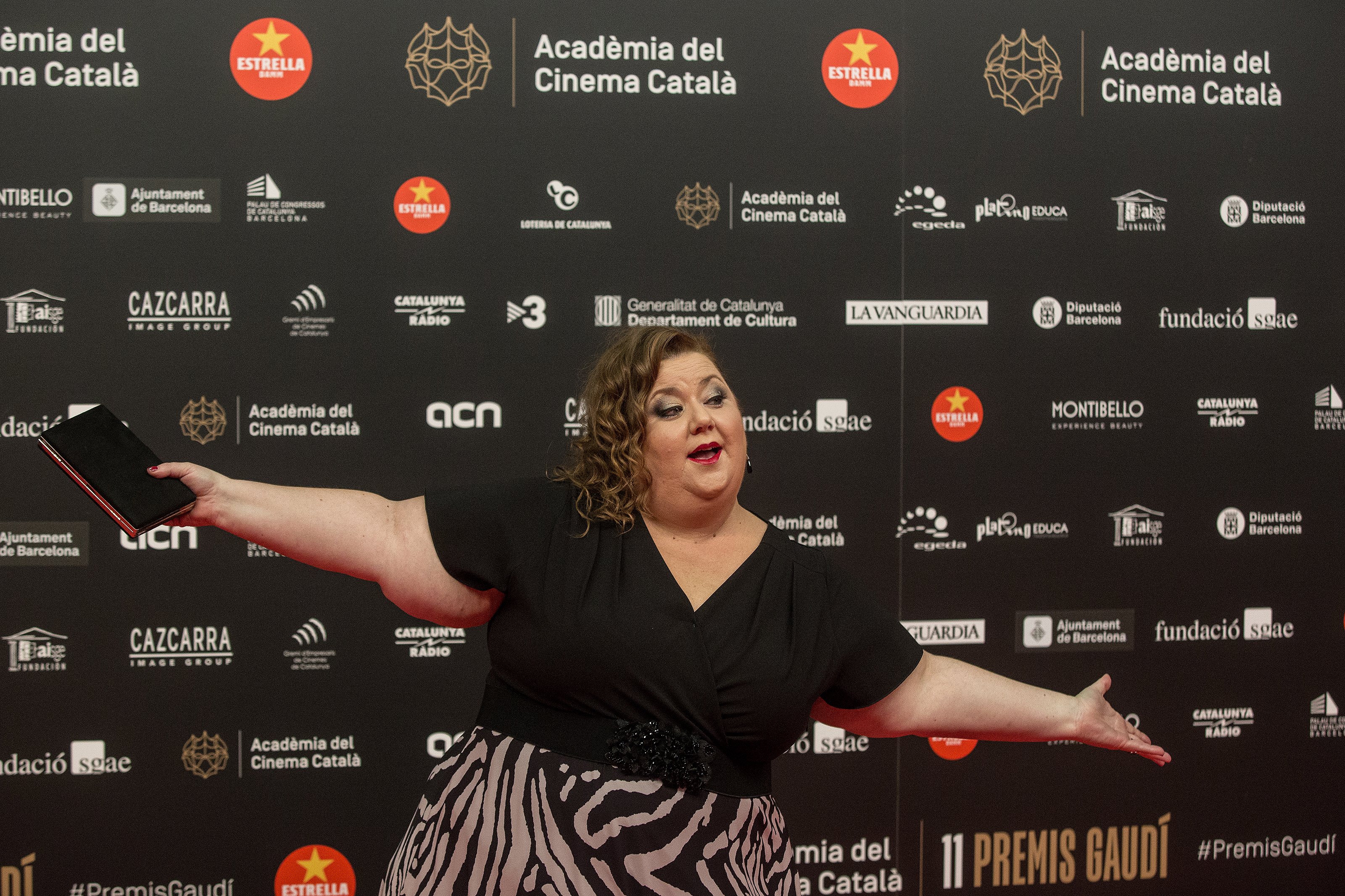 ¿Qué es el lipedema? La enfermedad que tenía la actriz Itziar Castro