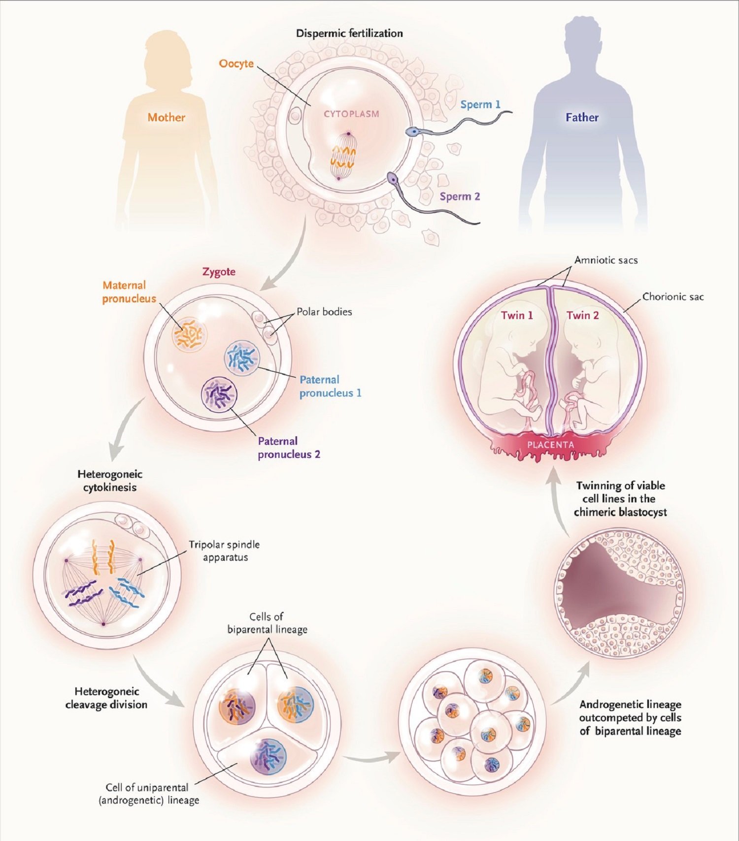 extracto de gabbett et al. n engl j med