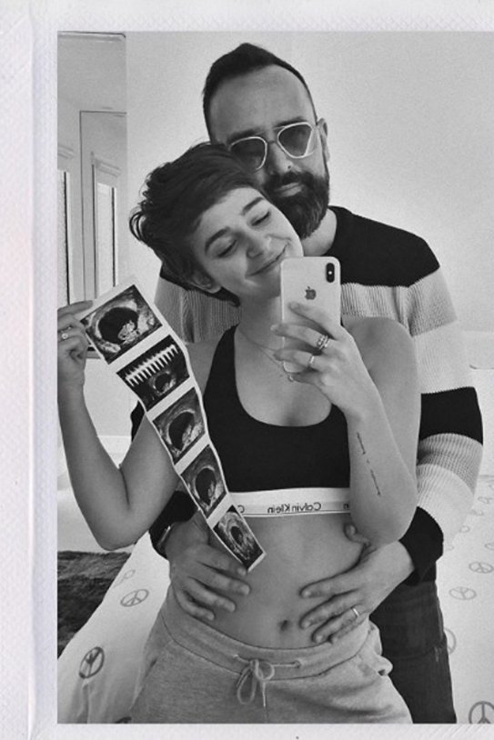 laura escanes risto mejide embarazada instagram ecografías